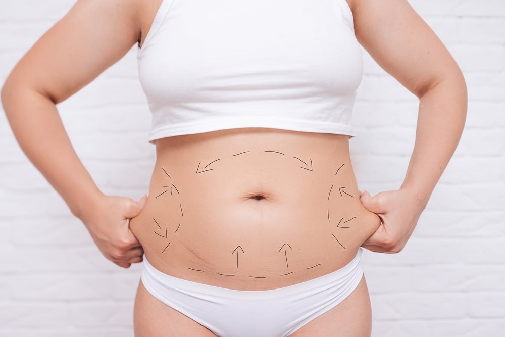 Body Contouring: How Long Does It Last? | BodyPoint Medspa