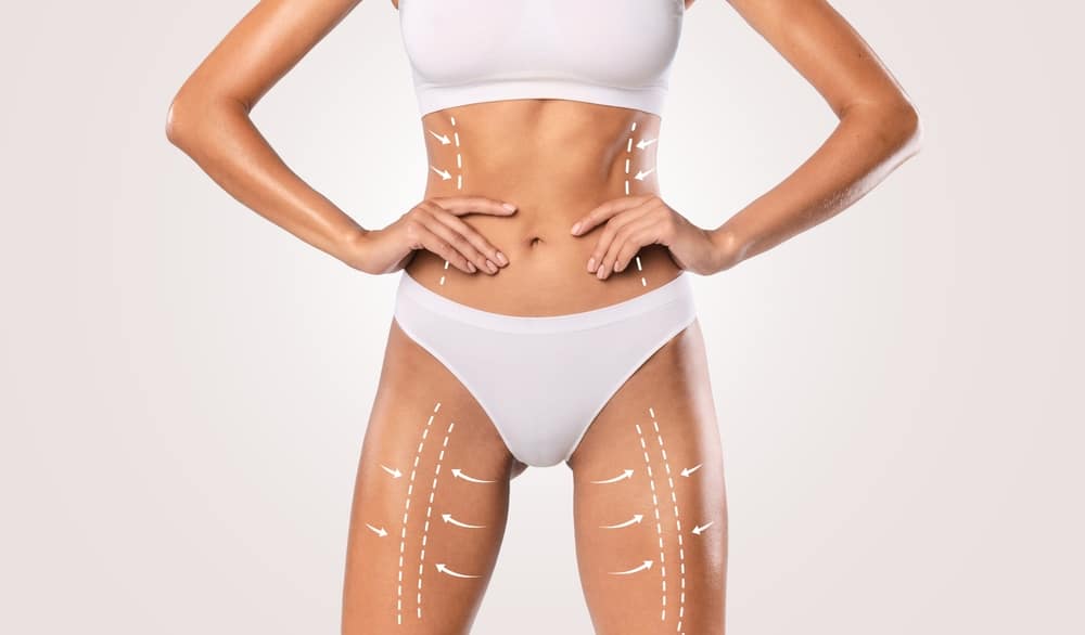 Reshaping Without Scars: Why BodyTite Is Minimally Invasive | BodyPoint