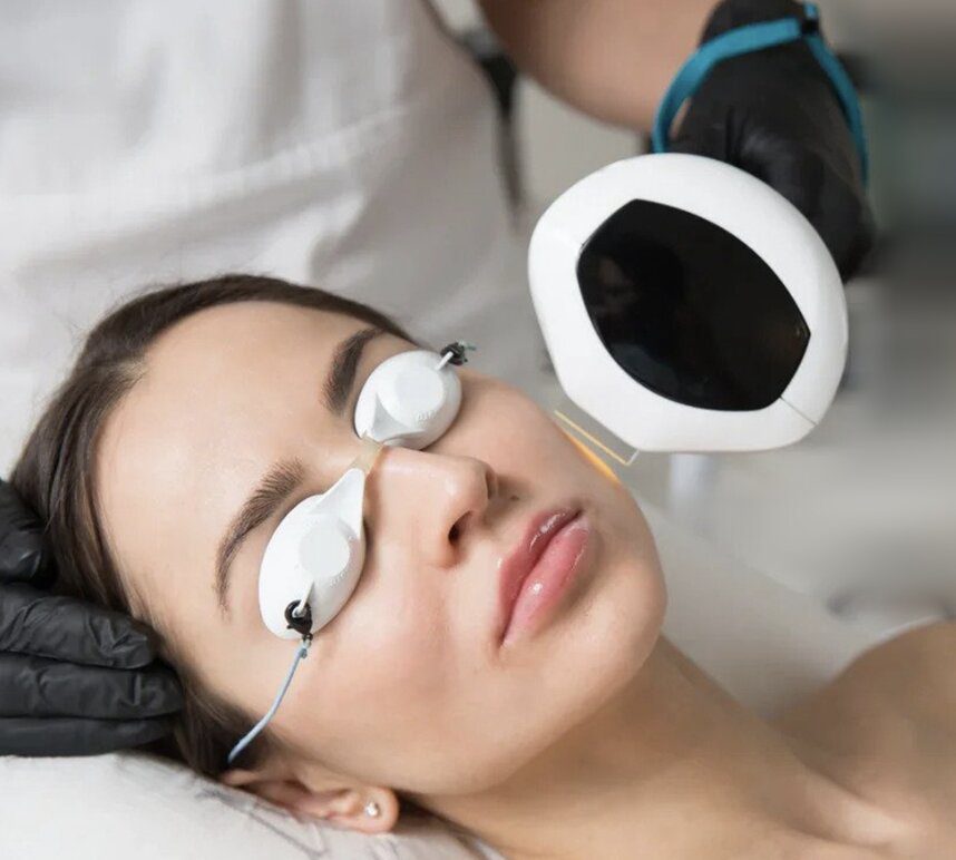 Lumecca IPL treatment by InMode at BodyPoint Medspa in Lehi, Utah