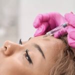 Botox injections for wrinkle treatment at BodyPoint Medspa in Lehi, Utah